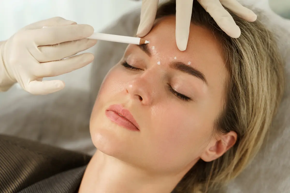 A che età iniziare con la medicina estetica: i consigli di Silvia